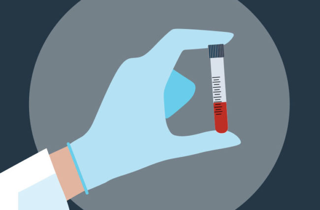 Thyroid Peroxidase Antibodies (TPO) Test